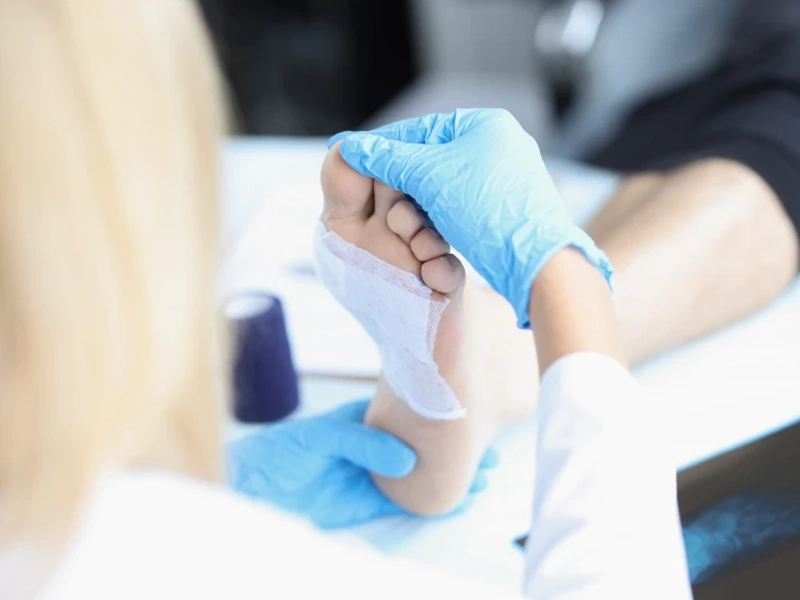 wound healing